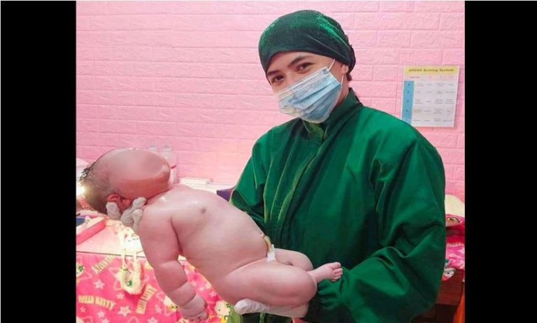 5.1kg baby boy born in Bulacan