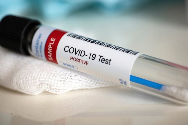 COVID-19 mass testing eyed to start on April 14