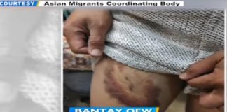 Filipina maid abused by employer in Hong Kong escaped