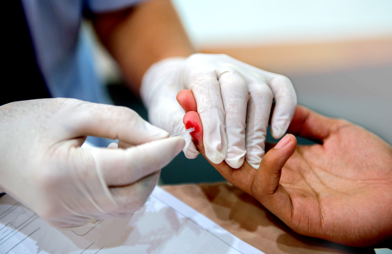HIV testing amid pandemic decreases- DOH