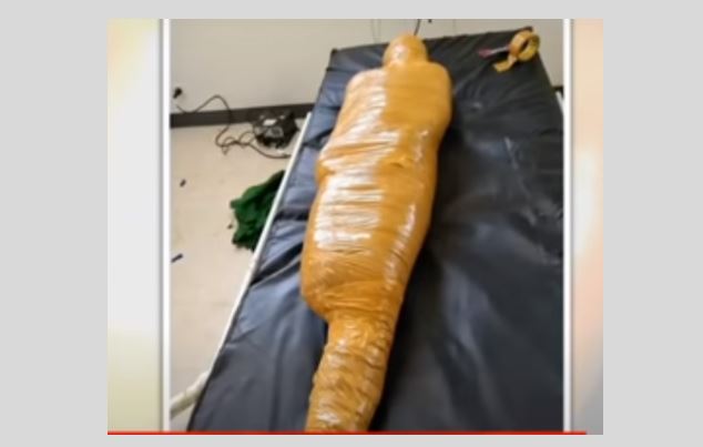 Hospital wraps road accident victim 'like a mummy' in packing tape