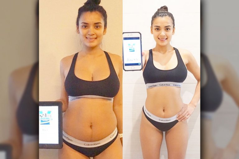 Michelle Madrigal had breast implant removal