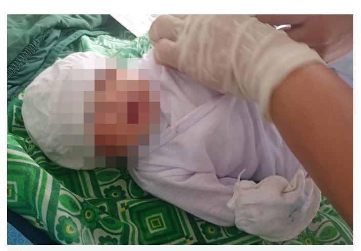 Pregnant woman dies of snake bite baby survived