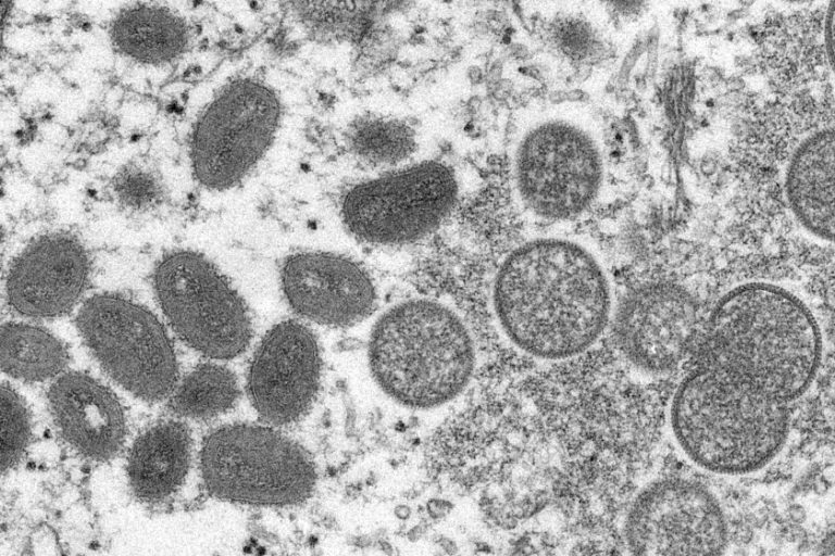 Philippines records 2 new cases of monkeypox