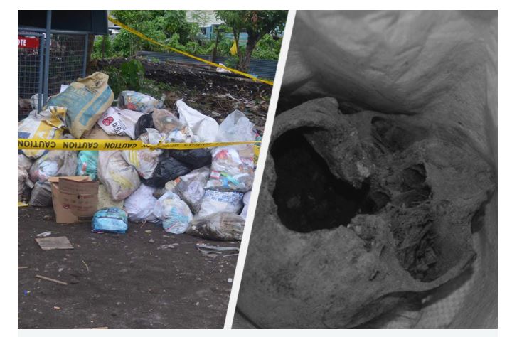 Skull from a cemetery found in garbage dump in Albay