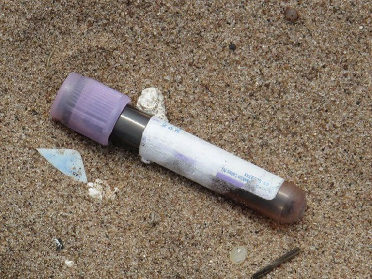 Vials with blood specimen washed ashore Subic Bay