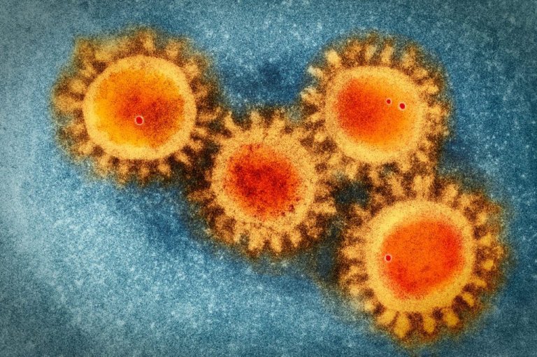 Globally dominant novel coronavirus strain detected in Philippines